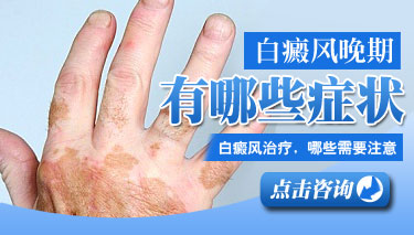 С<a href=http://www.bjhhtop.com/bdfzz/ target=_blank class=infotextkey>֢״</a>